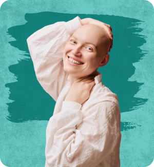 Alopecia Areata