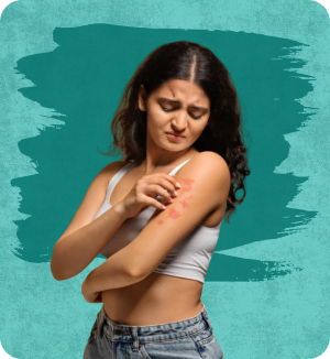 Atopic Dermatitis (Eczema)