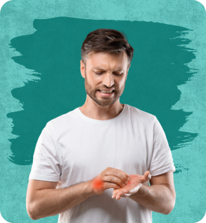 Chronic Hand Eczema_1